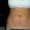 1 week before procedure